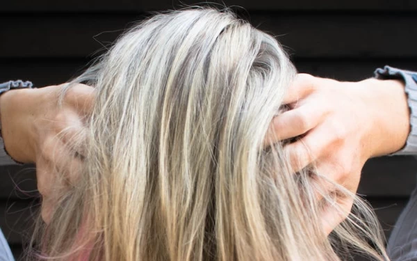 Thumbnail Berita - Beberapa Kebiasaan yang Tanpa Disadari Menimbulkan Rambut Beruban