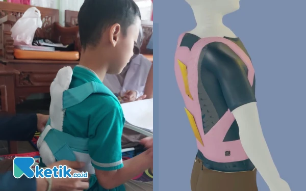 Thumbnail Berita - Solusi Kelainan Tulang Belakang pada Anak, Mahasiswa UB Ciptakan PostureCare