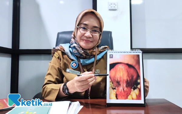 Thumbnail Berita - Tips Jaga Mulut Sehat ala Dokter Gigi Spesialis Penyakit Mulut RSUD dr. Darsono Pacitan