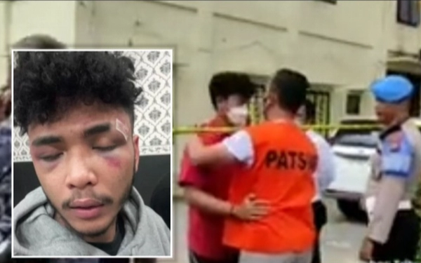 Ken yang Dianiaya Anak Perwira Polisi, Ternyata Pamannya Bukan Orang Sembarangan